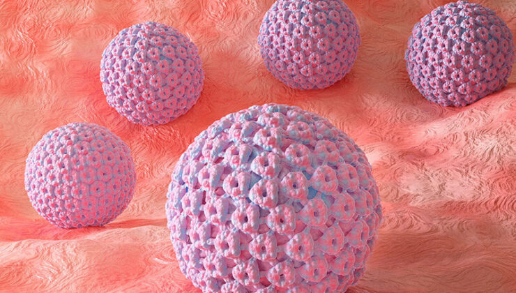 Genital Siğil (HPV) Nedir? Genital Siğil (HPV) Tedavisi Nasıl Yapılır?